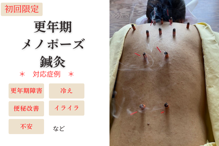 鍼灸院ふんわり 【お試し】更年期（メノポーズ)鍼灸のメニュー画像