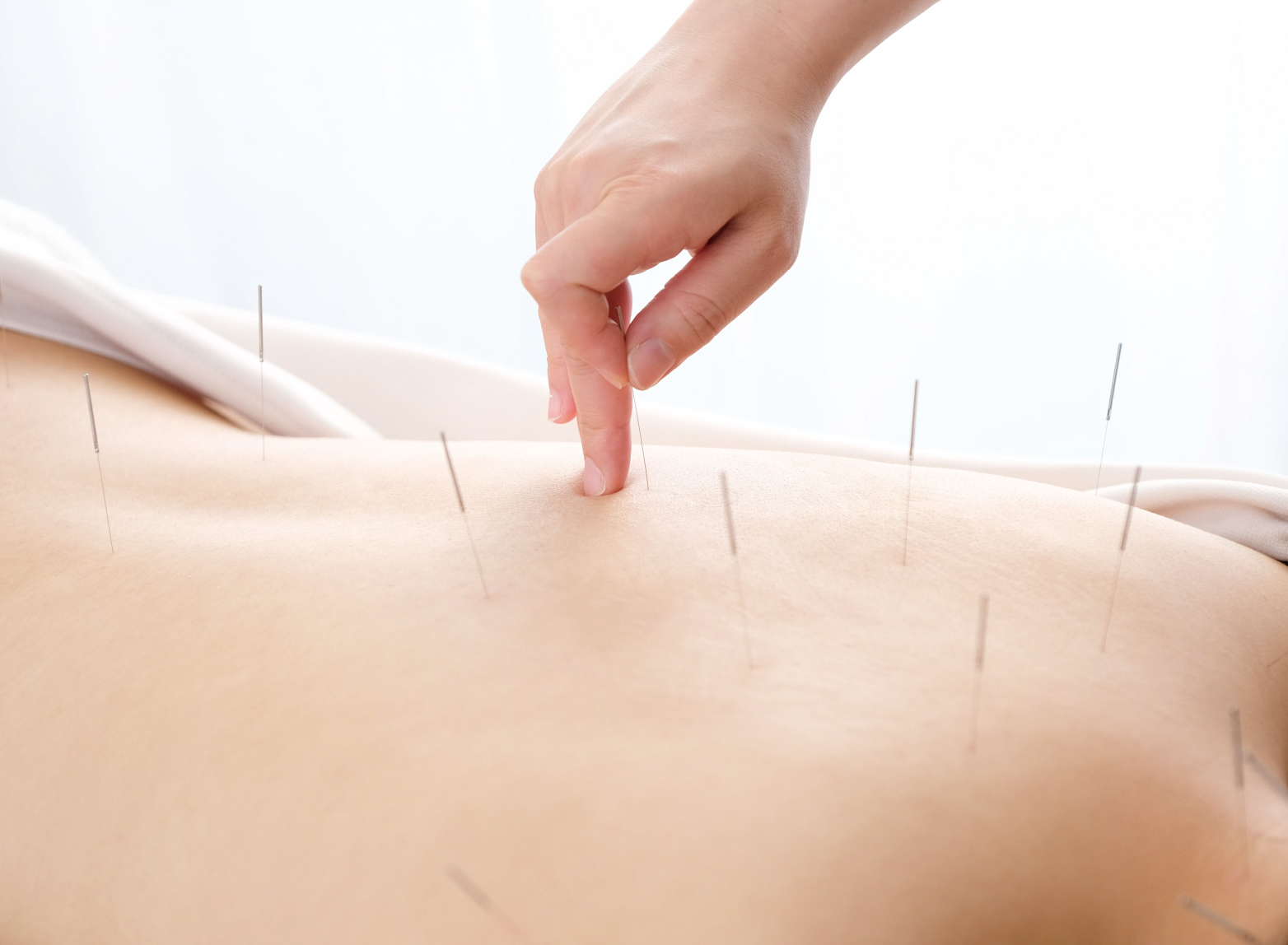 板東鍼灸整骨院　高砂院 【藤村】鍼30分のメニュー画像