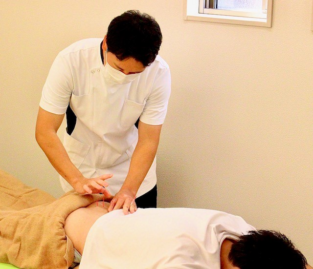 川越すずき鍼灸院 迷ったらこちらのコースのメニュー画像