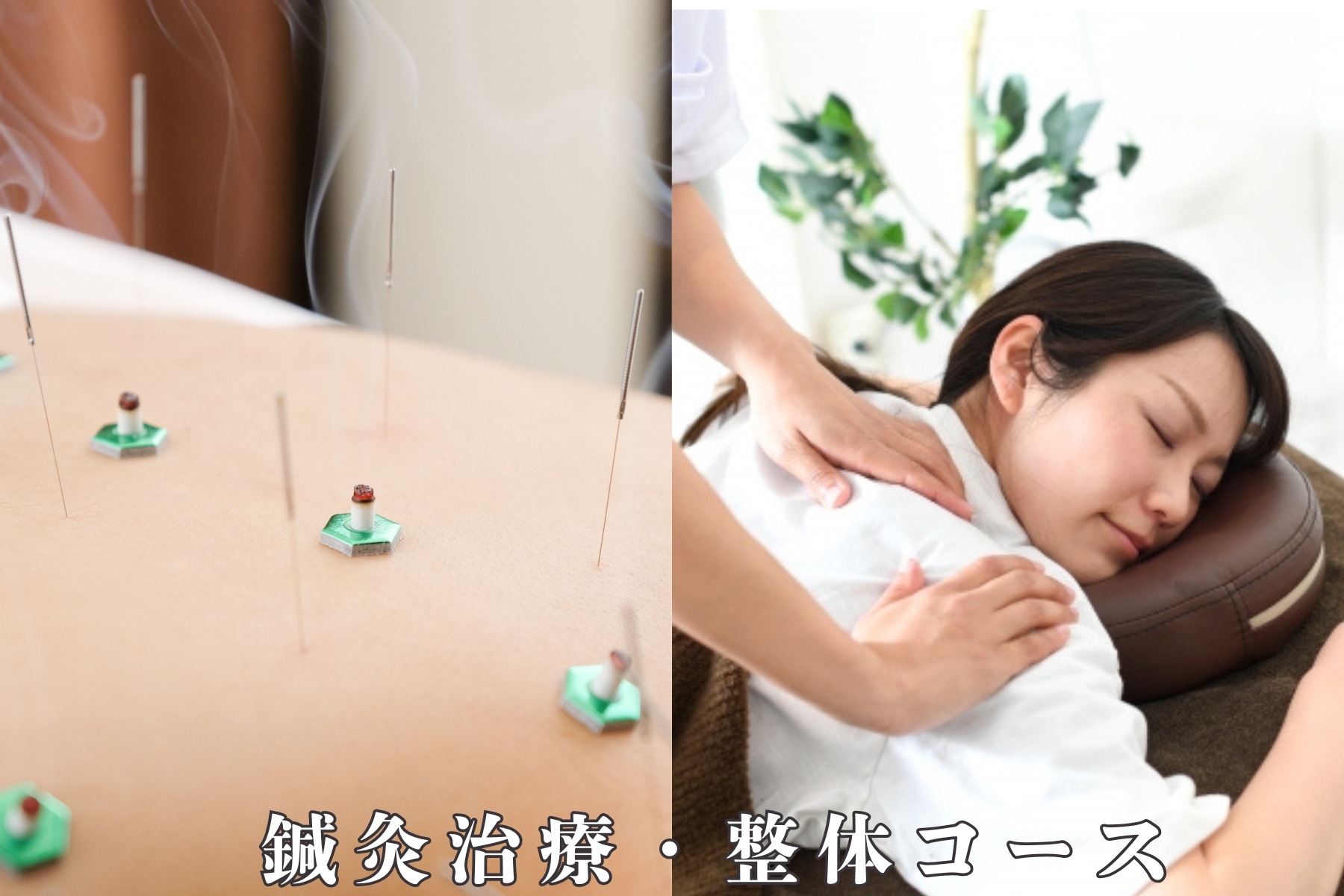 沖縄県那覇市首里スマイル鍼灸整骨院　本院 鍼灸・整体組み合わせコース【初めての方】のメニュー画像