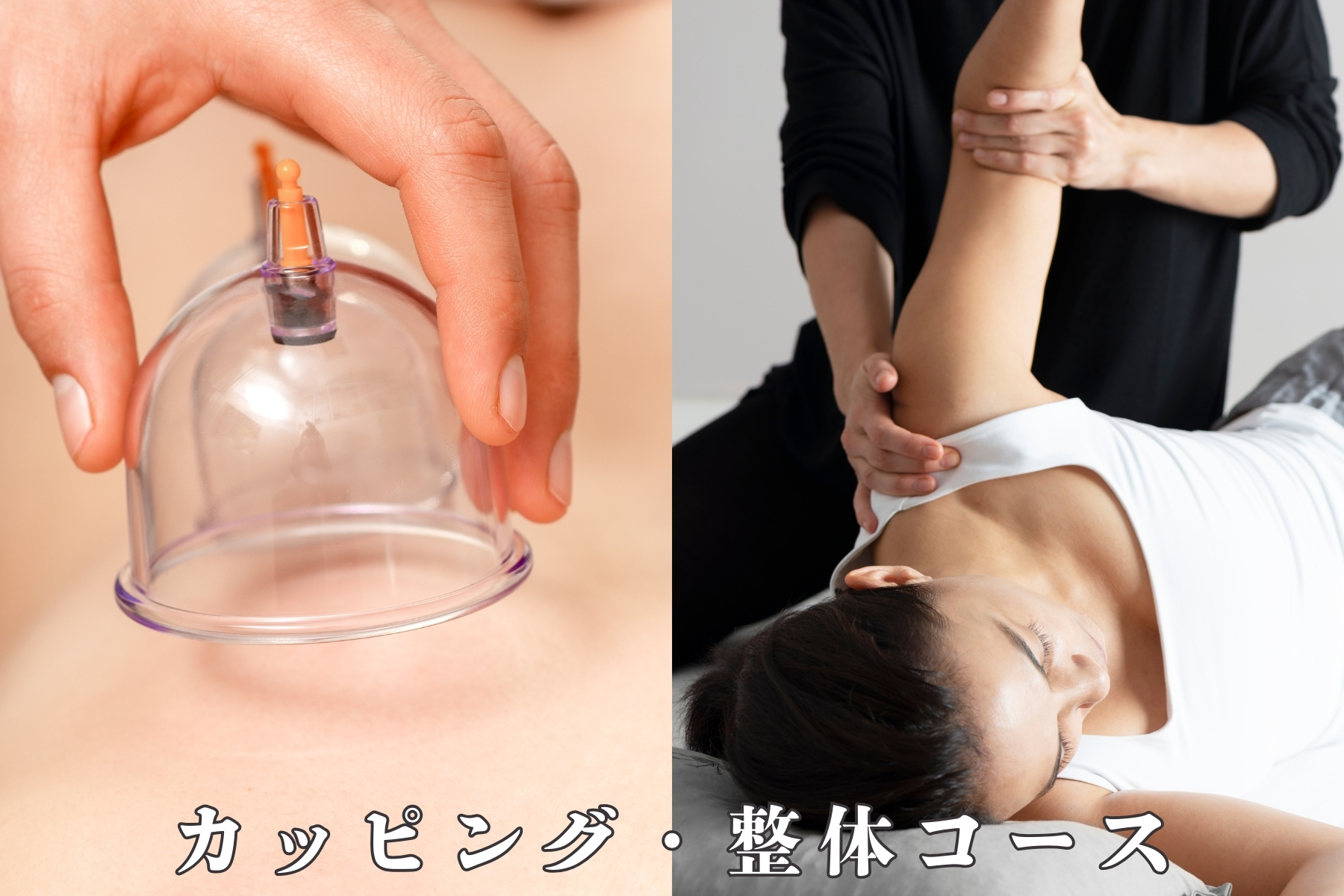 沖縄県那覇市首里スマイル鍼灸整骨院　本院 【デトックスコース】カッピング・整体組み合わせコース【初めての方】のメニュー画像