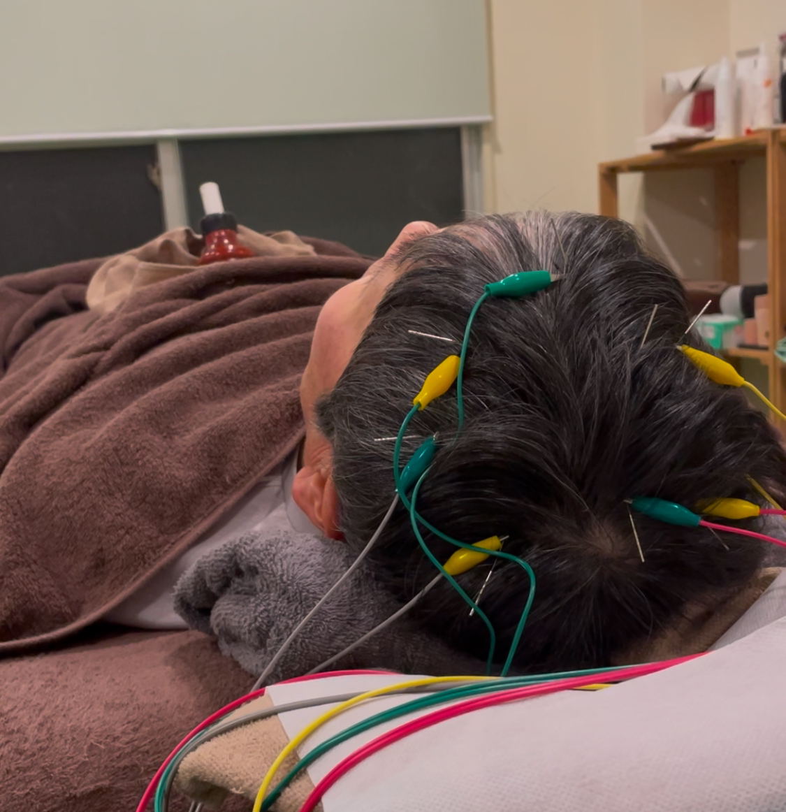 Akira鍼灸Conditioning Lab 薄毛鍼灸 養生コースのメニュー画像