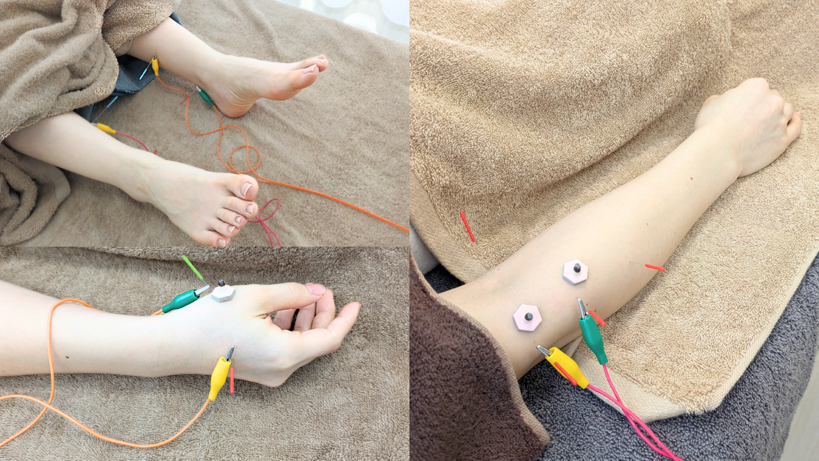 はりきゅうeFu -エフ- 【新規】肘・膝・関節部等のワンポイント治療/2回目以降5,000円のメニュー画像