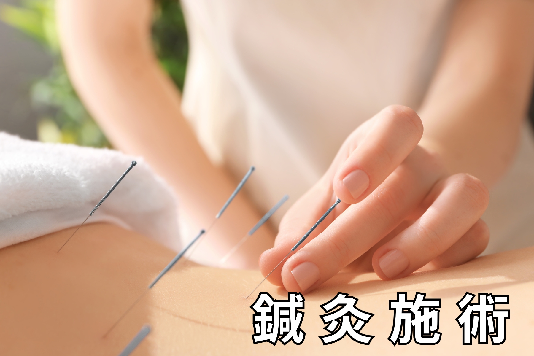 沖縄県那覇市首里スマイル鍼灸整骨院 本院 アップグレードコース【鍼灸治療】鍼の本数が増え、鍼灸施術の時間が長くなります。のメニュー画像