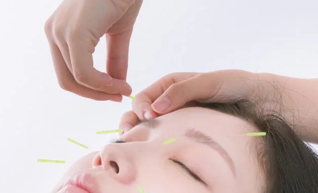 Owl治療室 健美顔鍼コースのメニュー画像