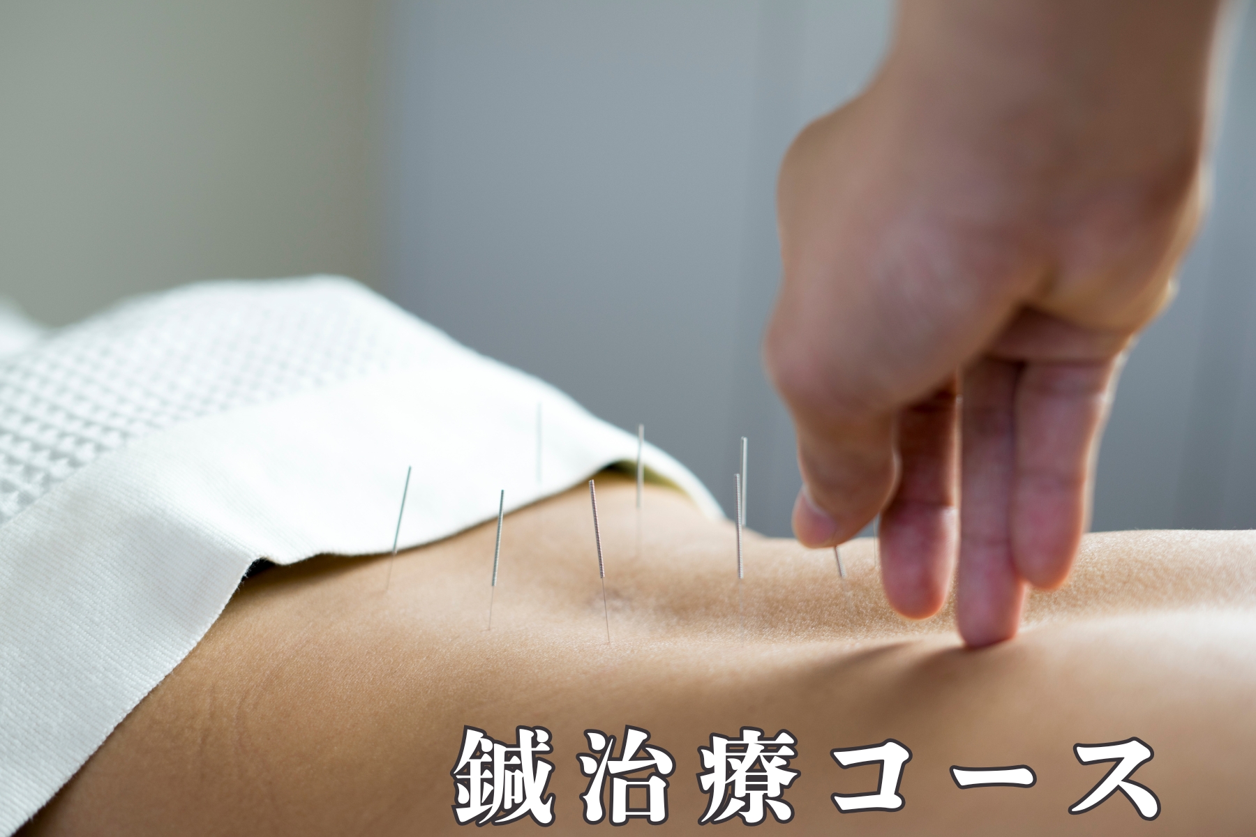 沖縄県那覇市首里スマイル鍼灸整骨院　本院 はりのみの施術コース【2ヶ月以内継続通院中の方、回数券を購入された方】のメニュー画像