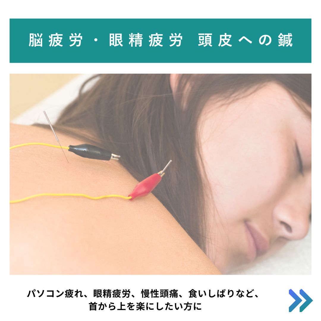 はり灸養生院いのうえ (初めての方)眼精疲労・脳疲労集中ケアのメニュー画像
