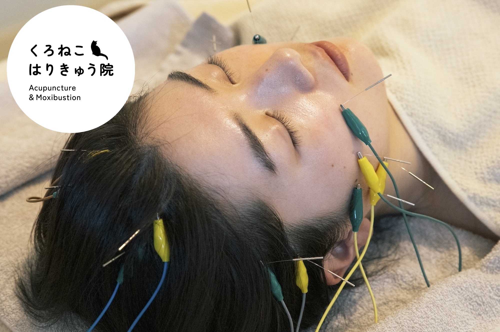 くろねこはりきゅう院 【初診】美容鍼(お顔と体)(通電あり)のメニュー画像