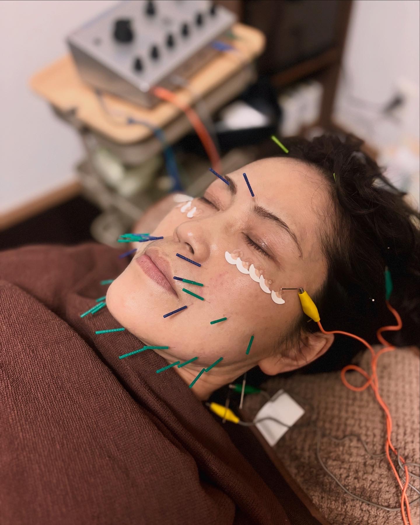 private salon 凪 美容鍼　スタンダードのメニュー画像
