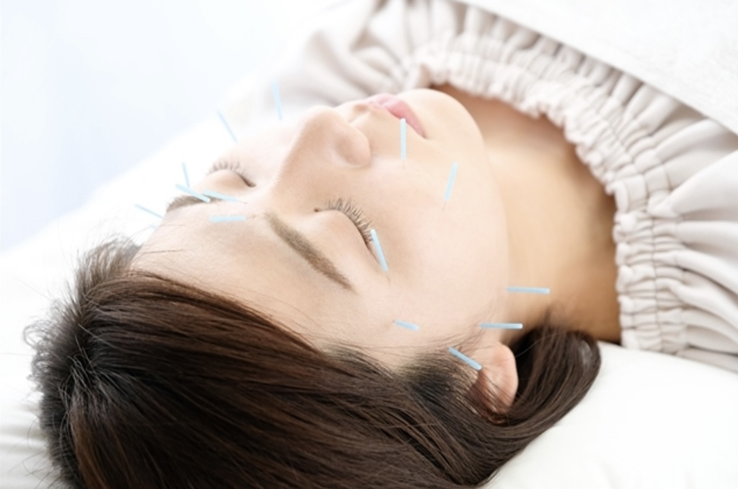 真はりきゅう接骨院 美容鍼のメニュー画像