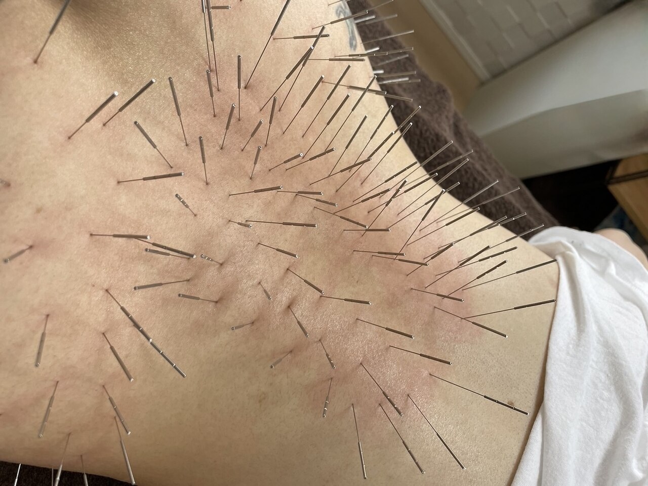 葵の葉鍼灸院 【慢性的な腰痛に！】ルート鍼施術 60分のメニュー画像