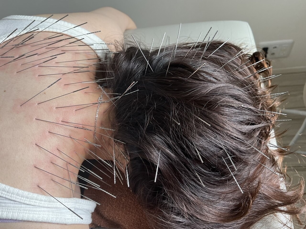 葵の葉鍼灸院 【オーダーメイド施術】ルート治療  120分のメニュー画像