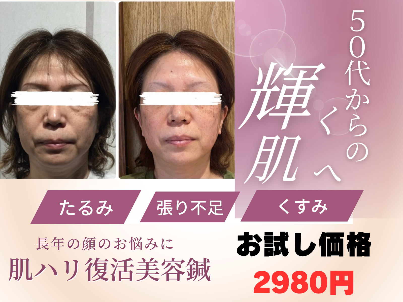 鍼灸整体サロンねこのひげ ご新規のみ【鏡を見るのも辛い顔のたるみ集中ケアコース】お試し4980円のメニュー画像