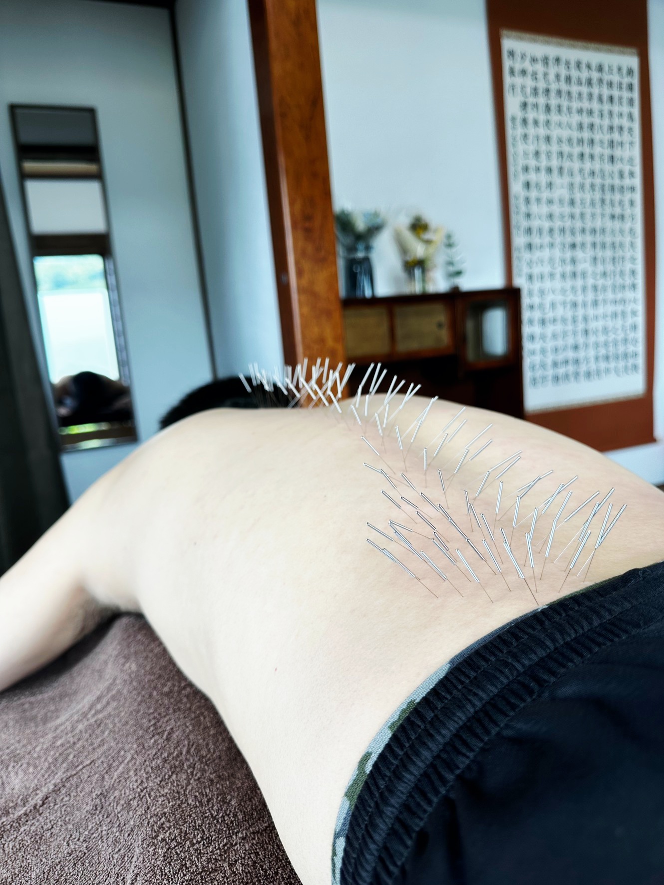 ゆたか鍼灸院 ルート鍼施術　60分のメニュー画像