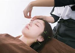 はりきゅう ゆるり治療院 【初めての方】美容鍼(美顔鍼灸)のメニュー画像