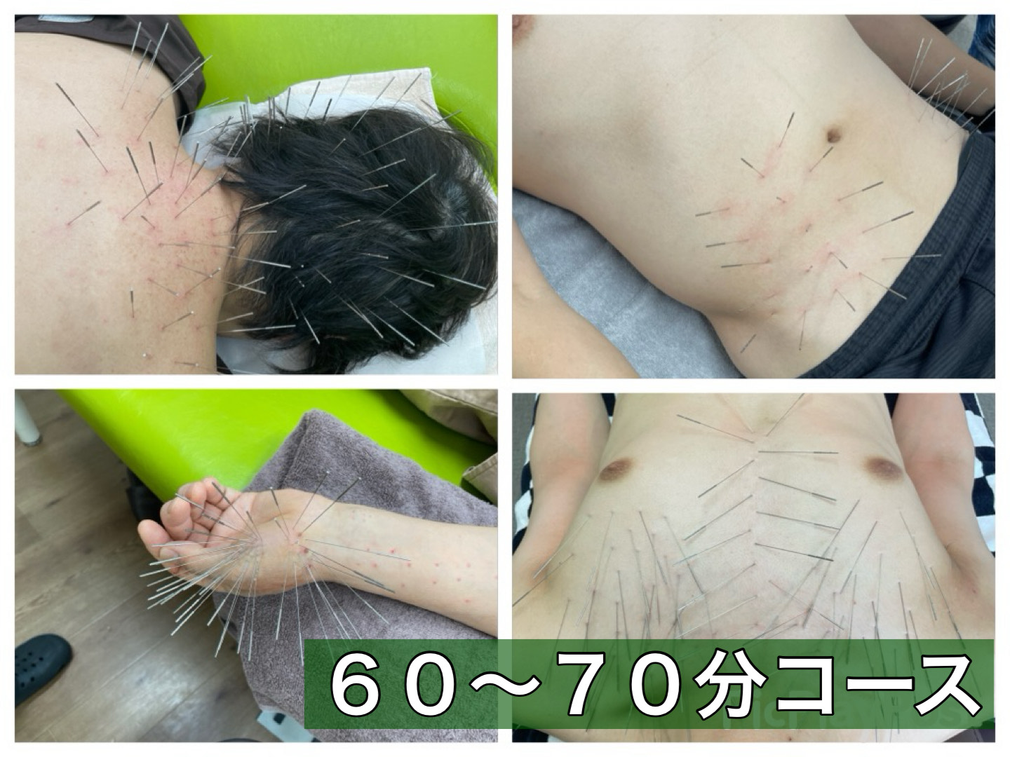 からだリメイク整骨院 ルート治療６０分~７０分コースのメニュー画像