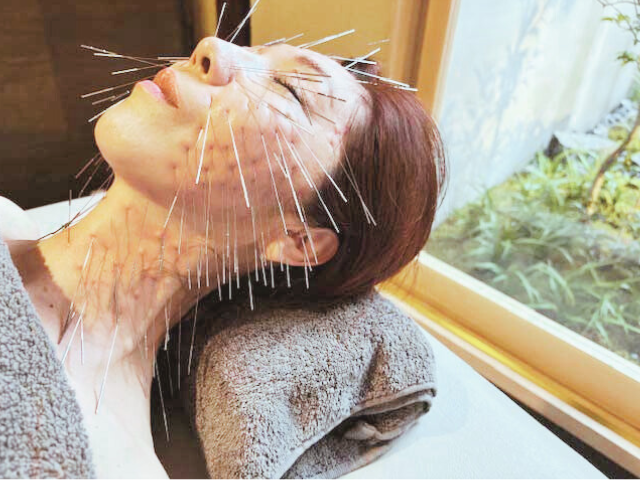  【京都四条烏丸】美容鍼灸サロン龍ノ穴（ルート治療認定院） 美巡鍼 -BI JUN SHIN-（ルート鬼美容鍼＋巡り調整）のメニュー画像