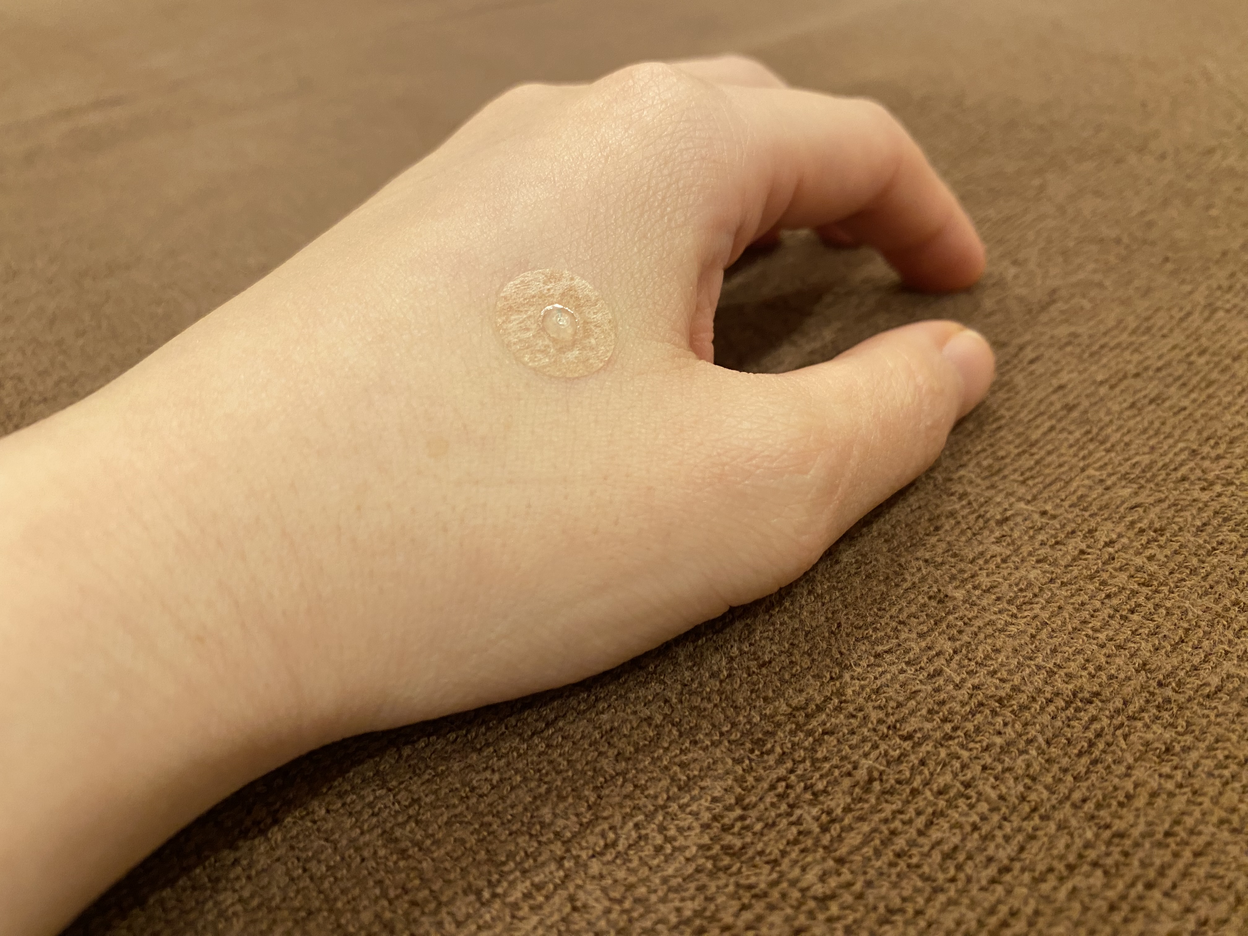 かなで鍼灸院 女性のための治療院 置ばり（円皮鍼）【5本/セット】のメニュー画像