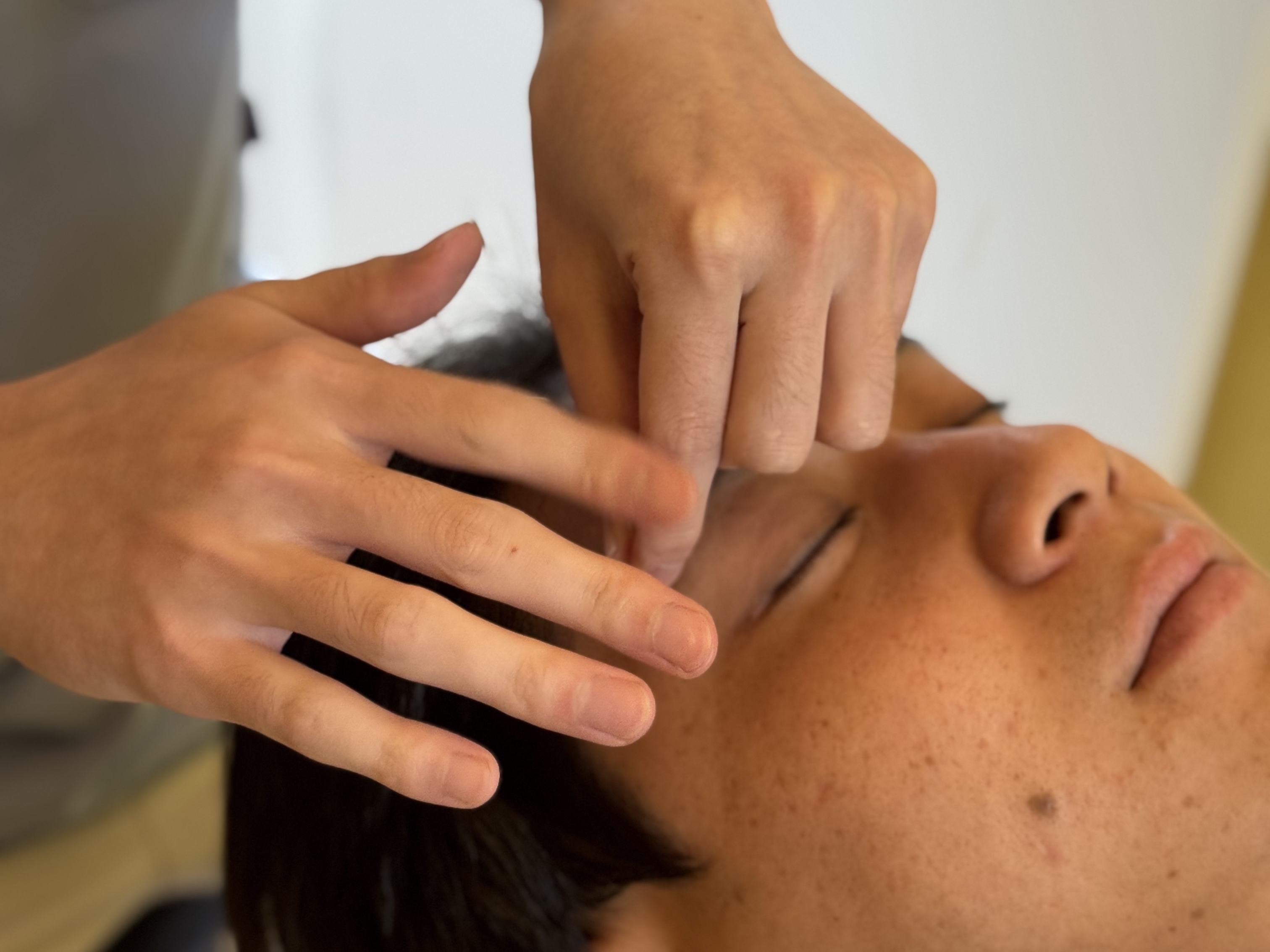 ゆめたか接骨院・鍼灸院大沢野院 男性専用美容鍼｜第一印象・清潔感・疲れ顔まで整える“身だしなみケア”のメニュー画像