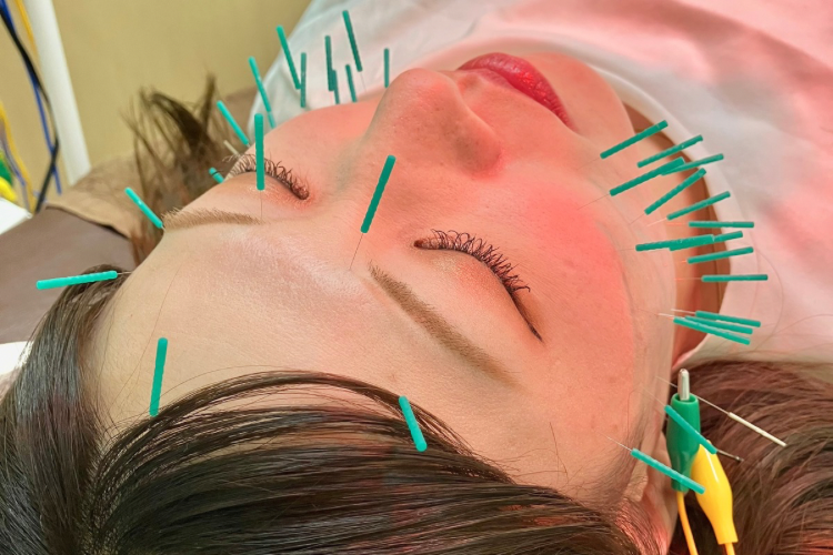 たけだ整体院鍼灸院 プロ施術で叶える美小顔◎小顔矯正＋美容鍼＋ヘッド】¥8800　鍼50本のメニュー画像