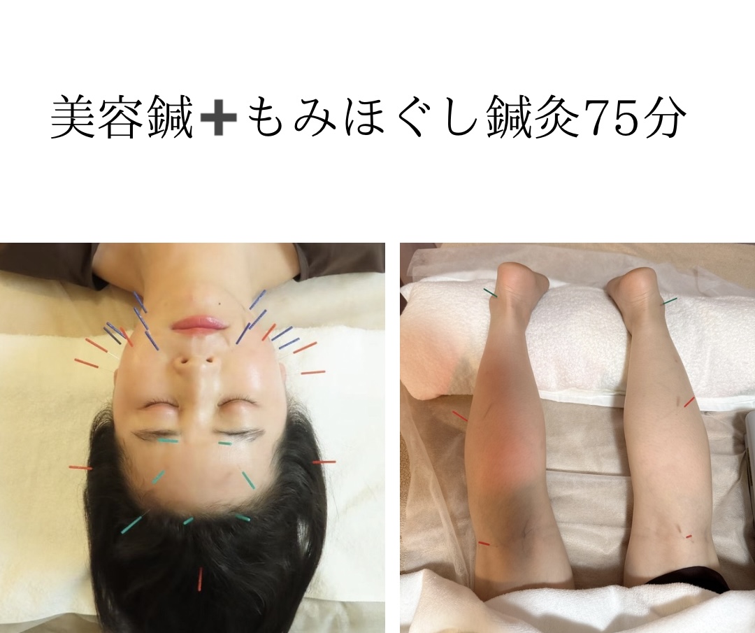 ジョンファ目黒鍼灸院 【初回限定】美容鍼➕身体もみほぐし鍼灸　75分のメニュー画像