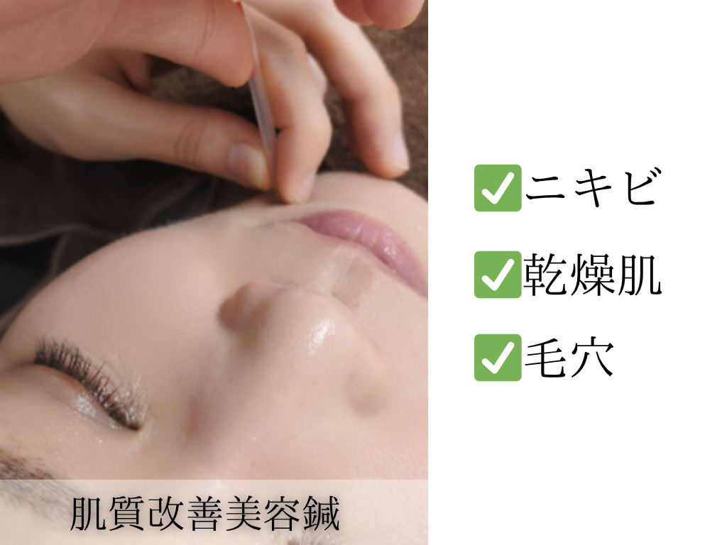 はりきゅうeFu -エフ- 【新規】『美容鍼』肌質改善コース/2回目以降6,000円のメニュー画像