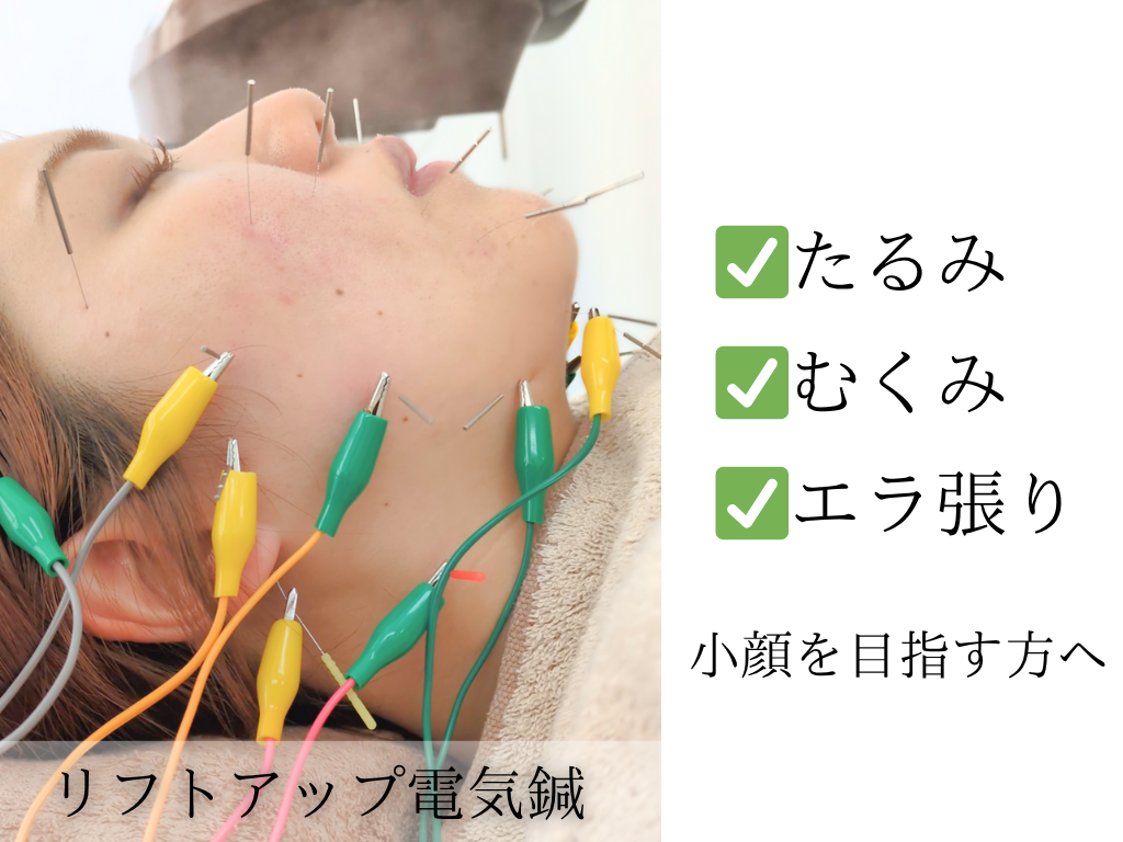 はりきゅうeFu -エフ- 【2回目以降】『美容鍼』リフトアップコースのメニュー画像
