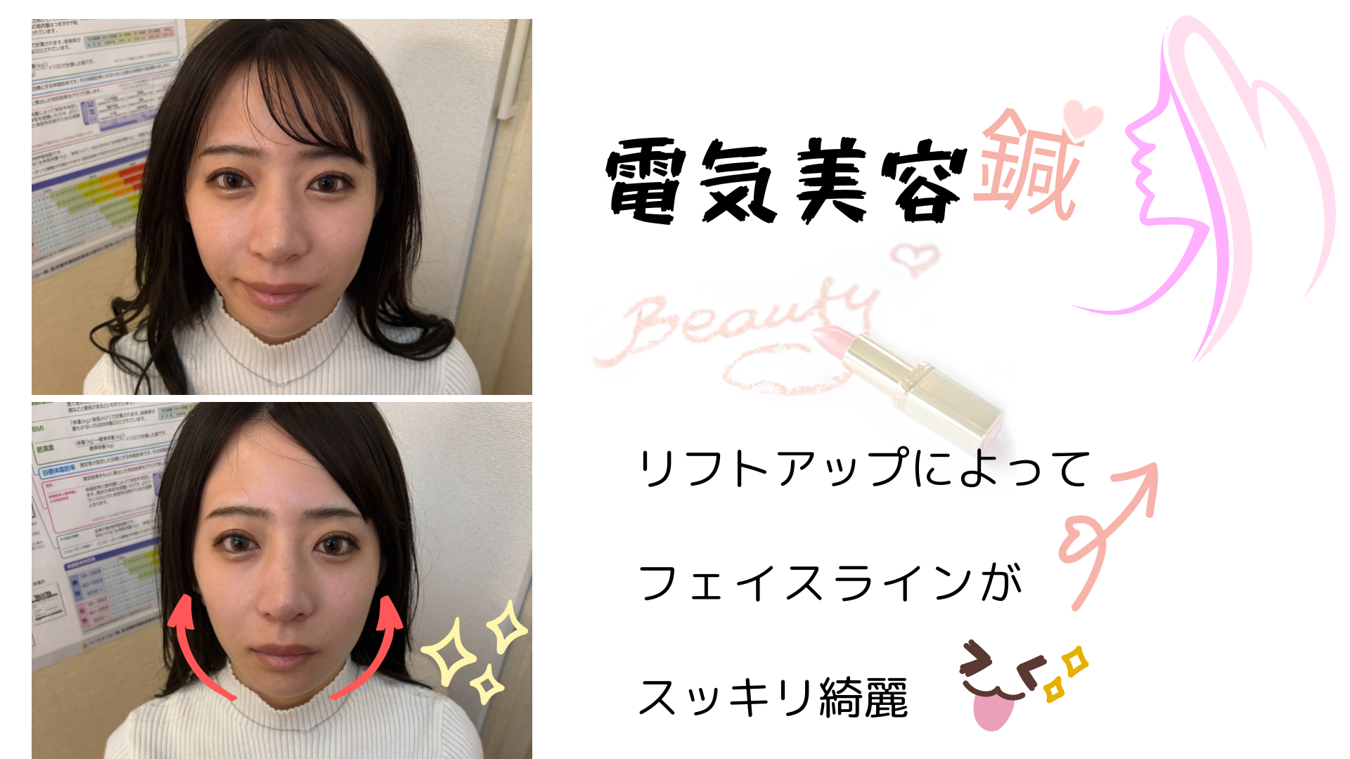 小林整骨院 天六 むくみ改善に特化した美容鍼♪のメニュー画像