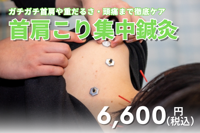 ハリス鍼灸整骨院 首肩こり集中鍼灸のメニュー画像