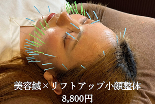女性専門きよもと鍼灸院 【当院人気No.1】Re make美容鍼×リフトアップ小顔整体のメニュー画像