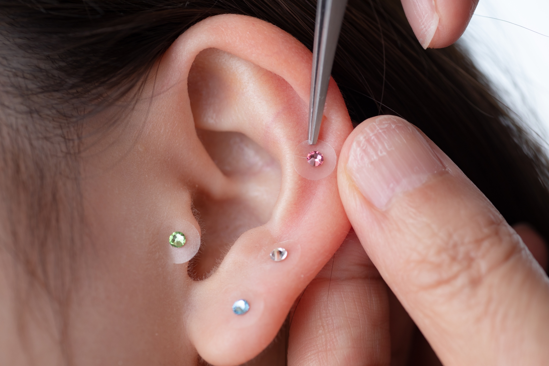 こさか鍼灸整骨院 耳ツボダイエット（初回カウンセリング含む）のメニュー画像