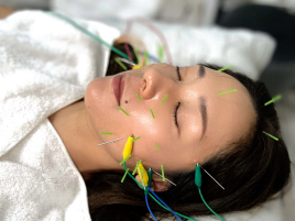 はりきゅうサロン　とうよう美　lazo 美容鍼　刺す鍼　または刺さない鍼のメニュー画像