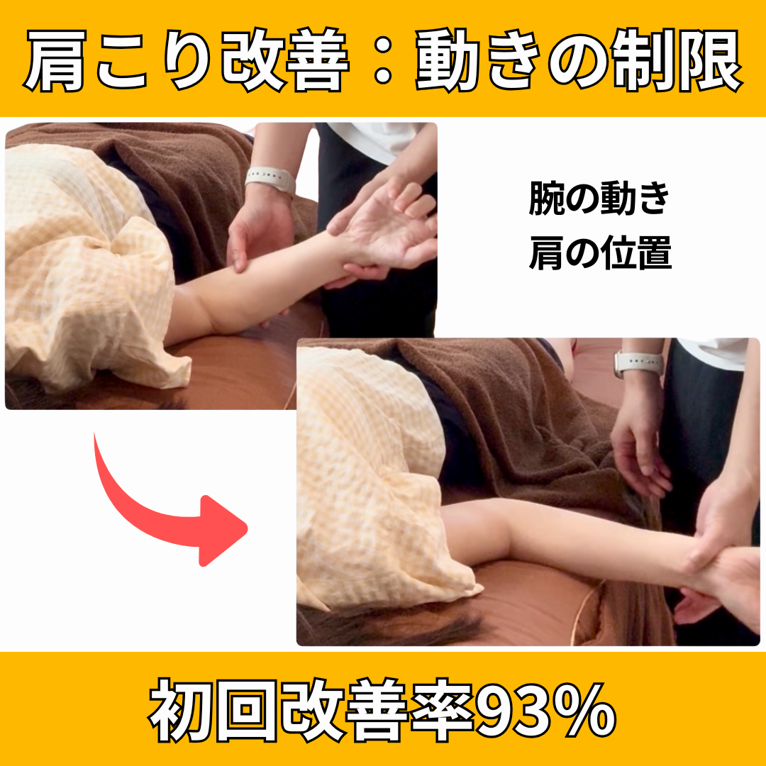 LaLa鍼灸サロン 【首肩こり改善】猫背・巻き肩は改善できる！姿勢老人卒業したい人はこちら！のメニュー画像
