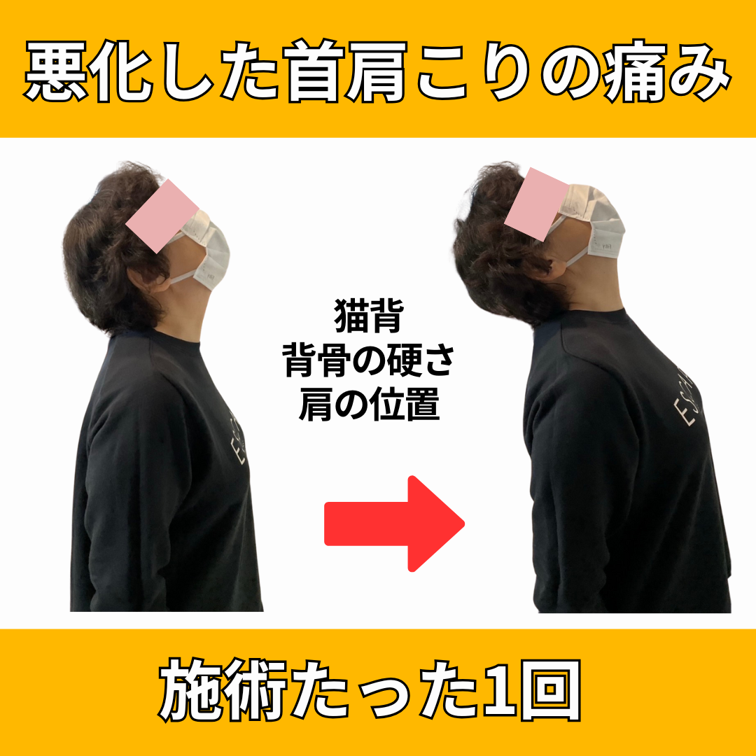LaLa鍼灸サロン 痛みが不快でイライラしている人はこちらから！初回改善率93％のメニュー画像
