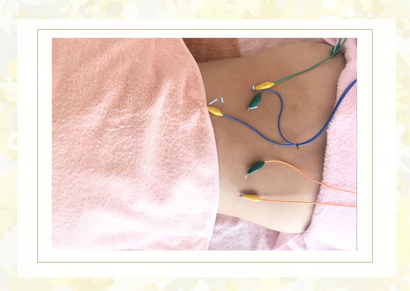 かすがい鍼灸院Re.heart 自律神経調整療法（電気はり療法）のメニュー画像