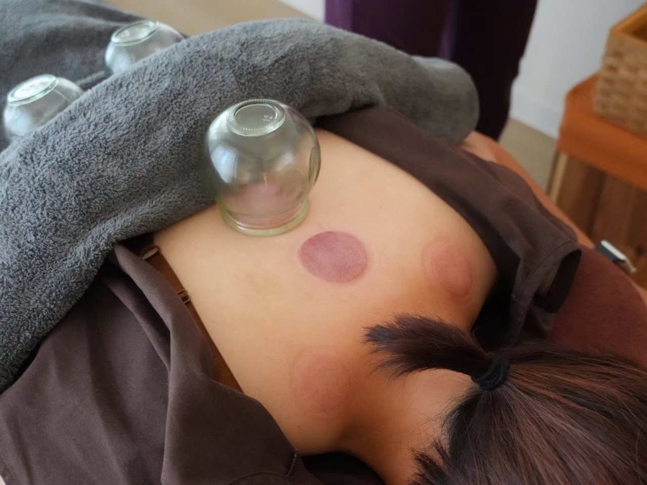 鍼灸こはり～女性と子どもの鍼灸サロン～ 鍼灸施術 ➕ 吸玉（カッピング）のメニュー画像