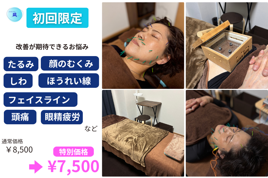private salon 凪 【初回】 美容鍼　スタンダードのメニュー画像