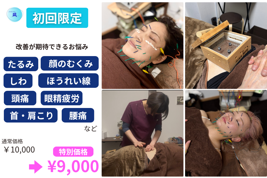 private salon 凪 【初回】 美容鍼　デラックスのメニュー画像