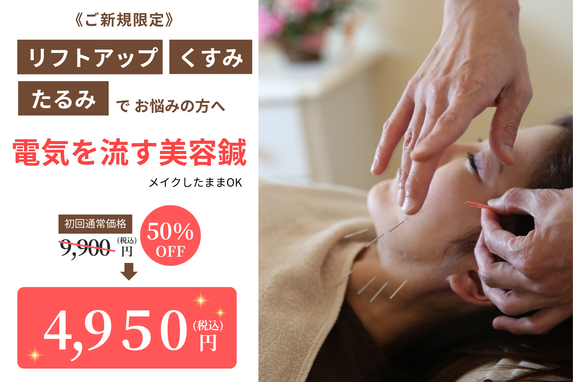 天使のはね鍼灸院｜あま市本院 初めての方【たるみ・むくみ・リフトアップ】電気を流す美容鍼のメニュー画像