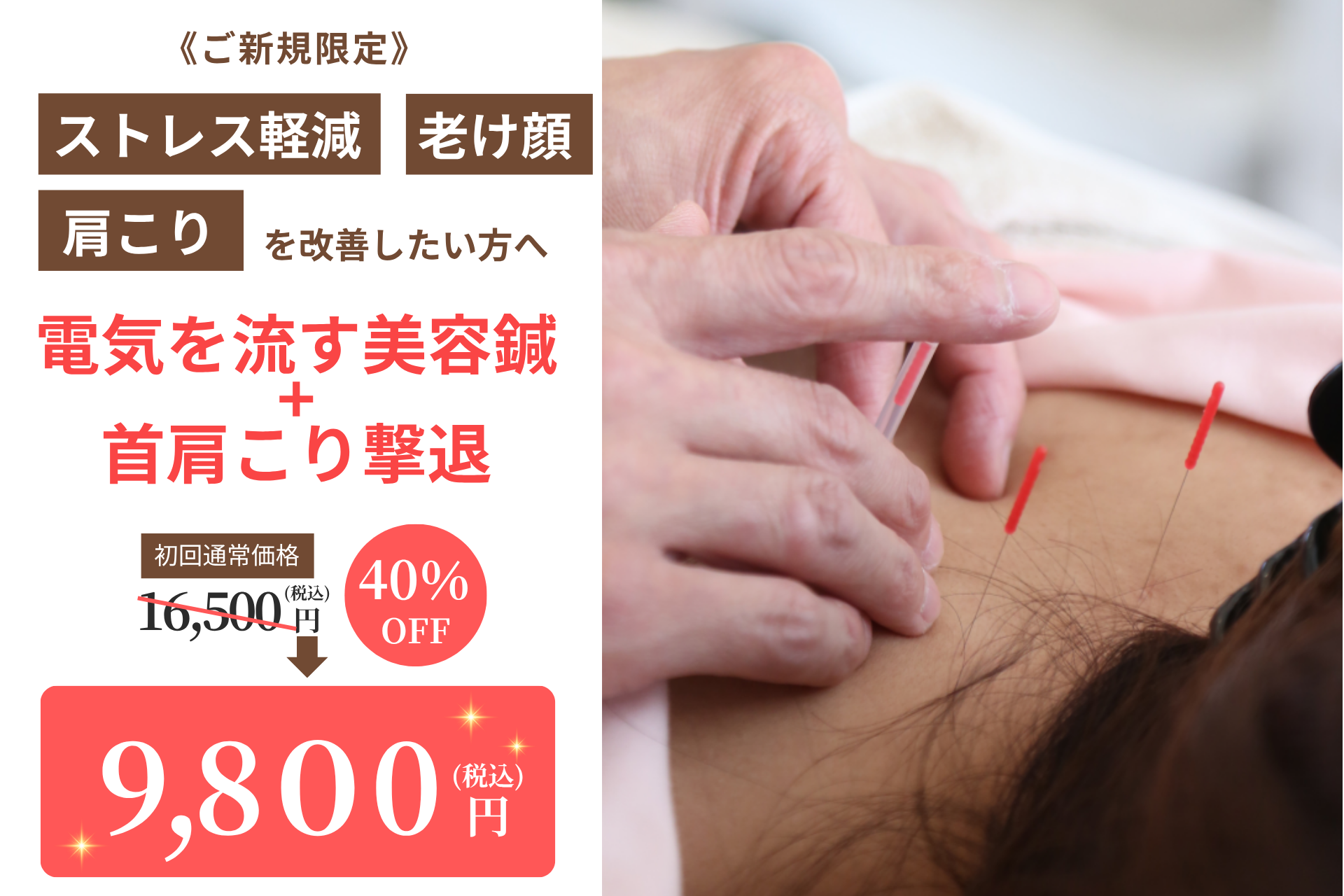 天使のはね鍼灸院|あま市本院 初めての方【疲れ顔の原因は首肩こり!?】電気を流す美容鍼+首肩こり治療のメニュー画像