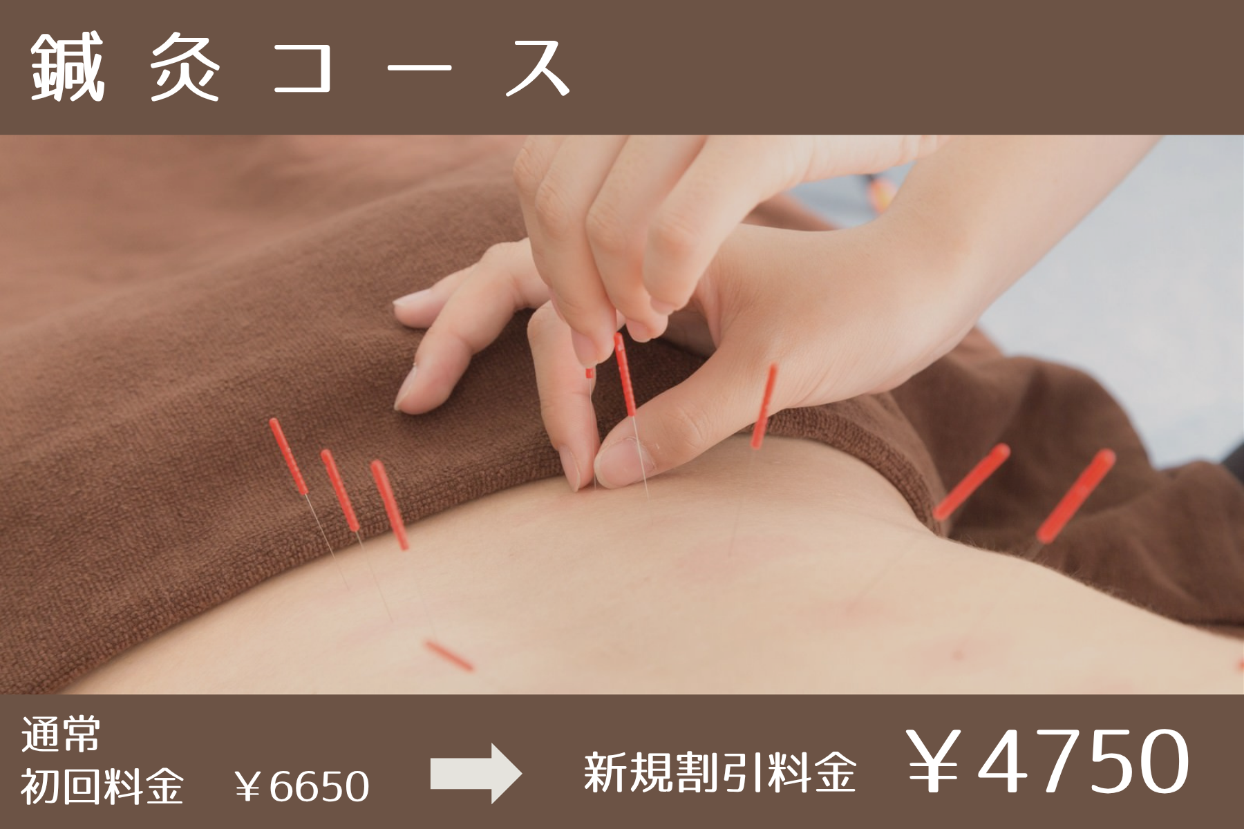 沖縄県那覇市首里スマイル鍼灸整骨院　本院 【新規限定割】鍼灸コース（スマイルオリジナル）のメニュー画像