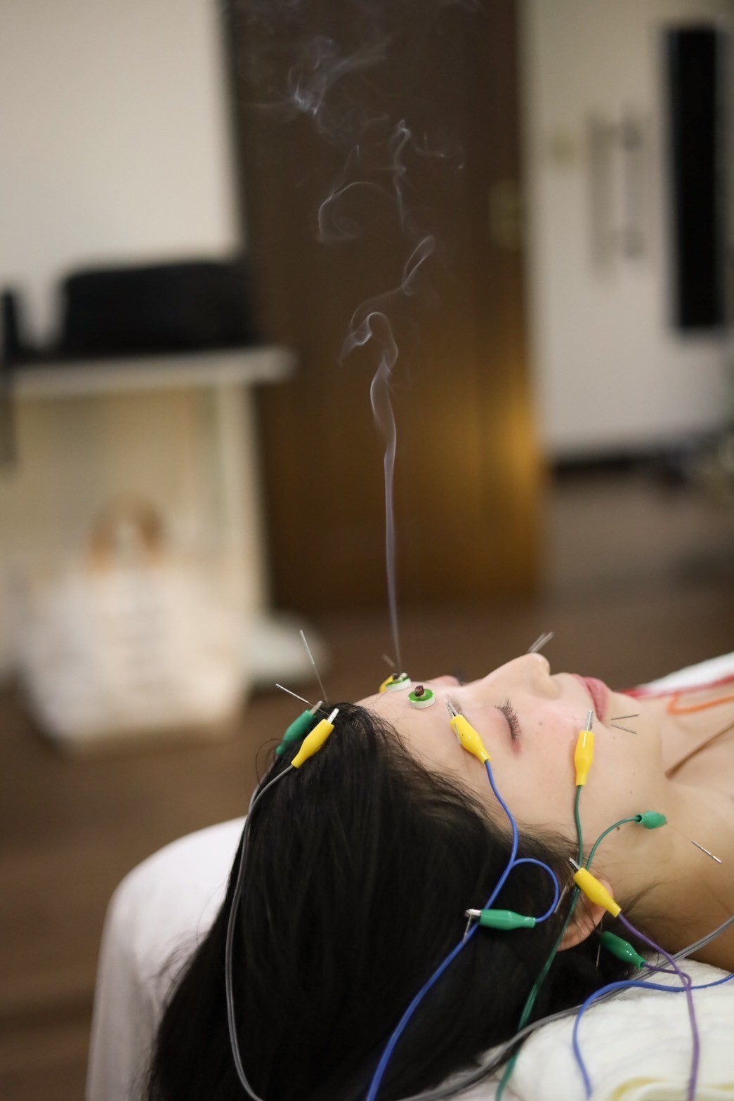 鍼灸ハリスト 通電美容鍼＋鍼通電フルコース治療のメニュー画像