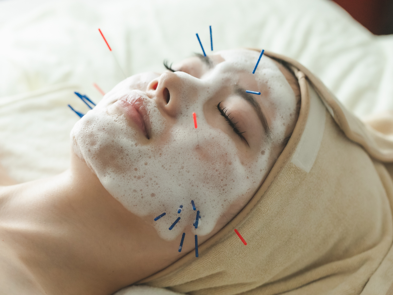 鍼灸ハリスト パック美容鍼のメニュー画像