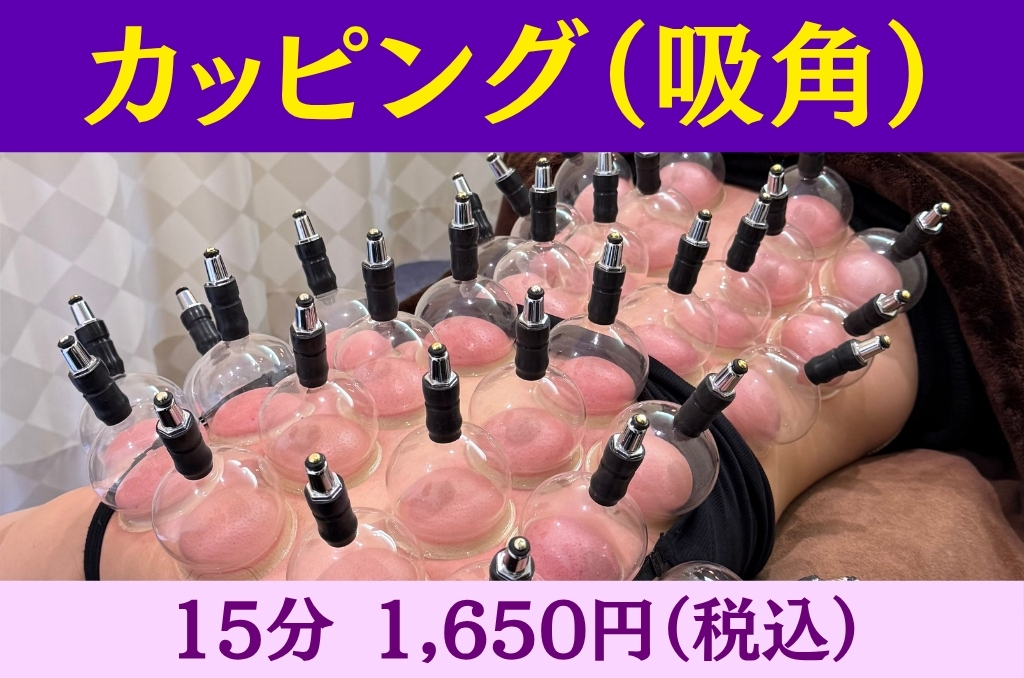 龍華鍼灸院 【オプション】カッピングのメニュー画像