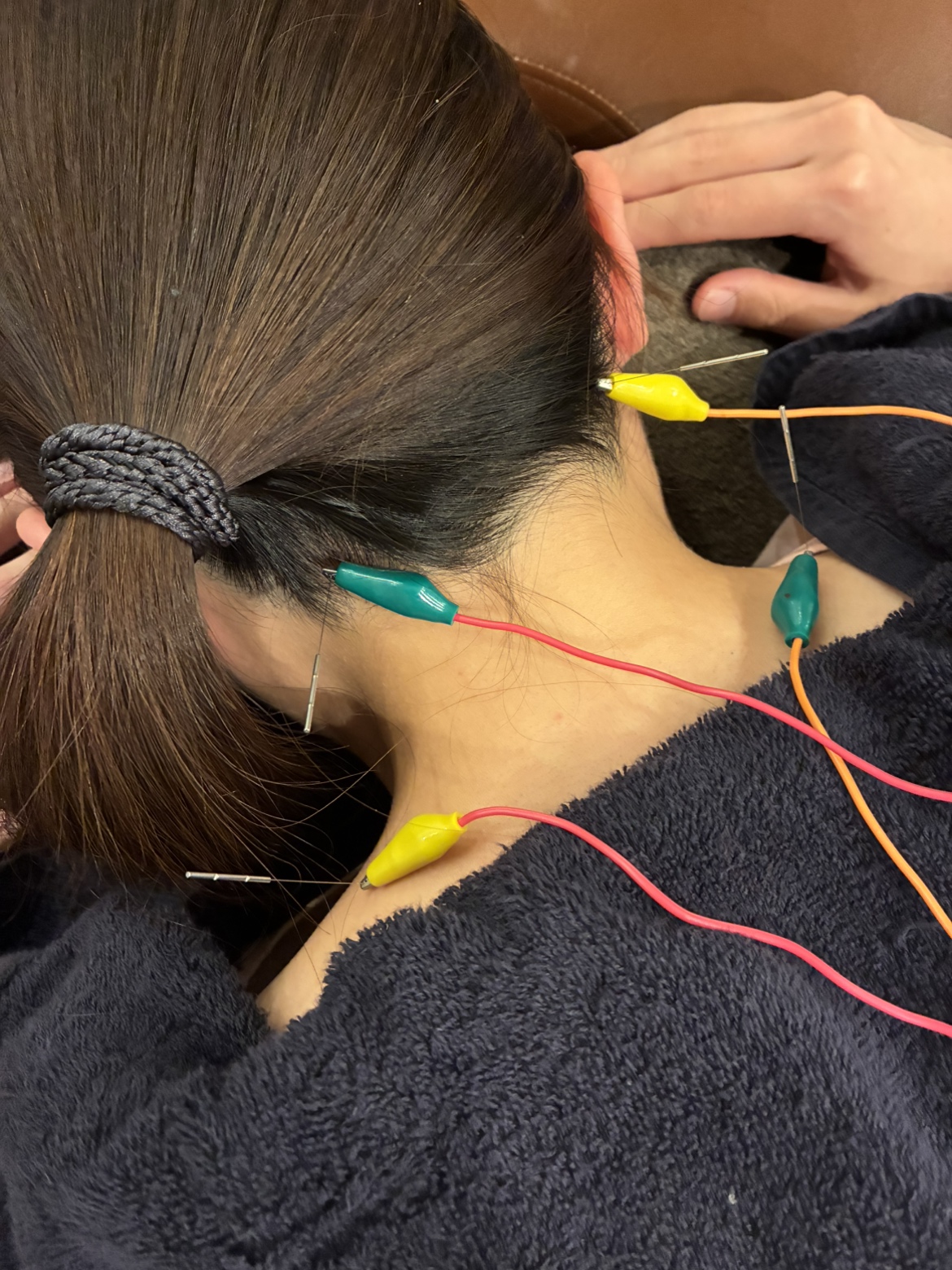 美容・不妊鍼灸 立川Ladies鍼灸マッサージ 産後ケア・更年期ケア 【初回ネット予約限定】自律神経鍼灸のメニュー画像