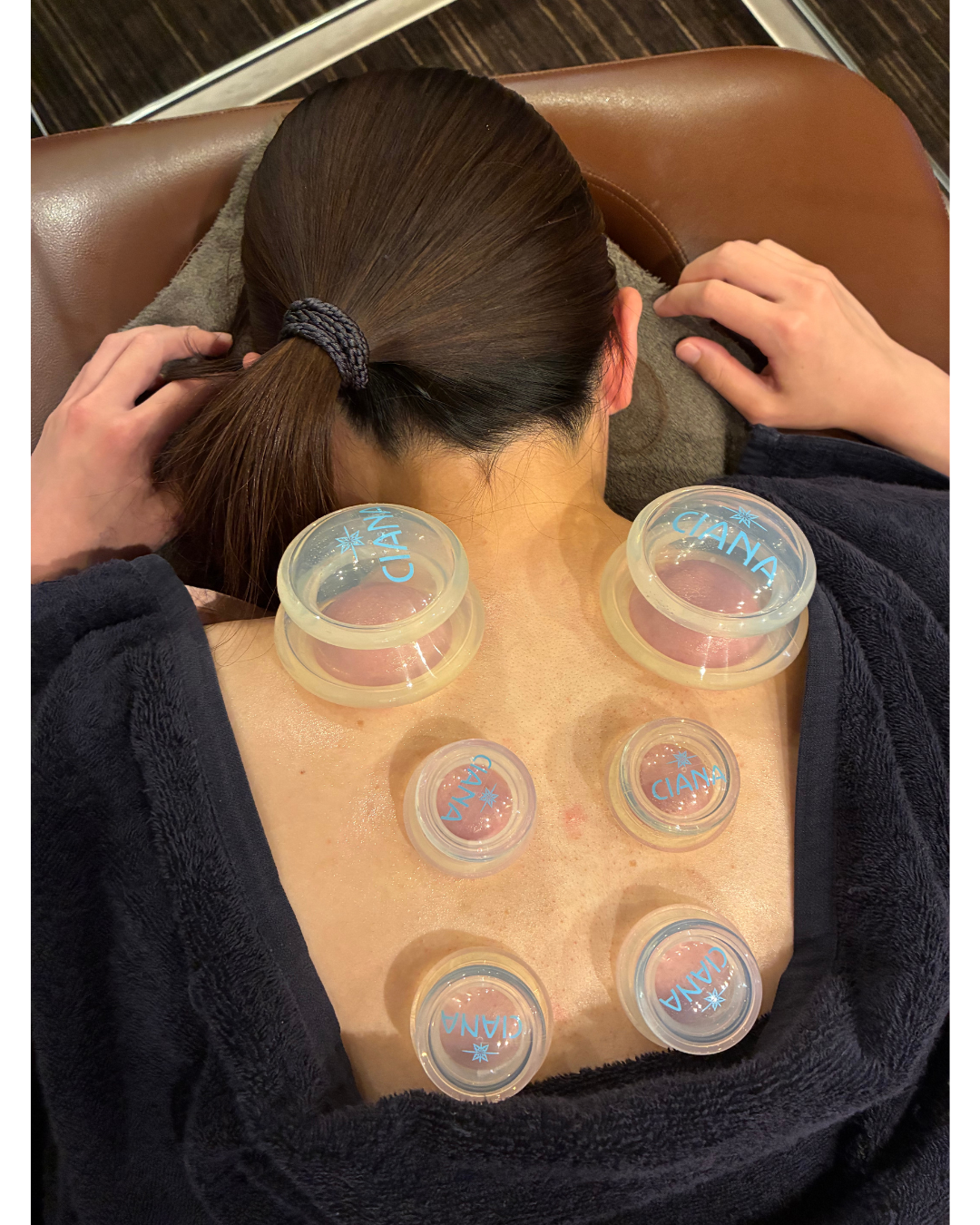 美容・不妊鍼灸 立川Ladies鍼灸マッサージ 産後ケア・更年期ケア ソフトカッピングのメニュー画像