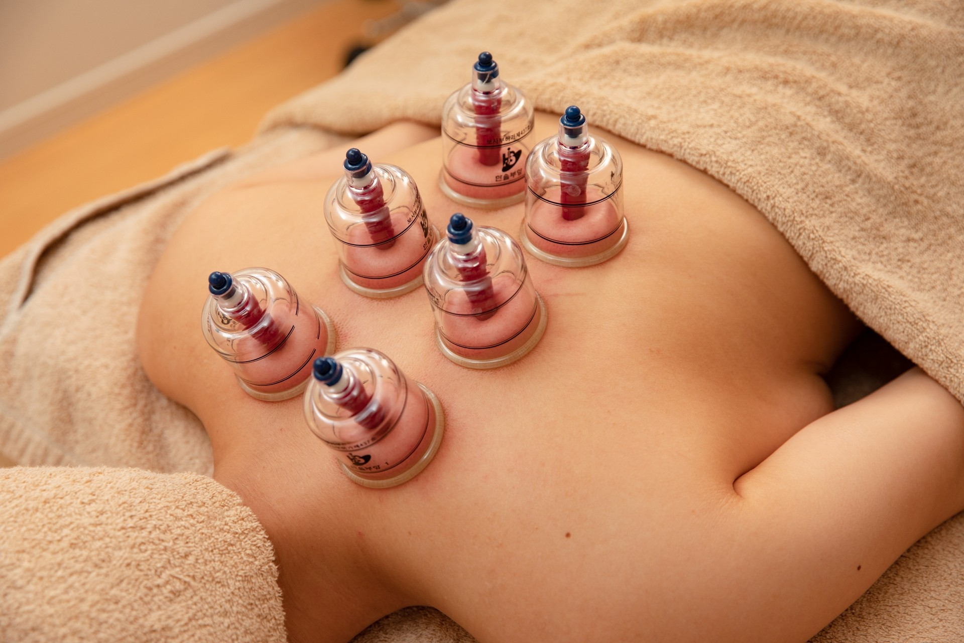 鍼灸ハリスト オイル吸玉背中コース（吸玉後、オイルマッサージ）のメニュー画像