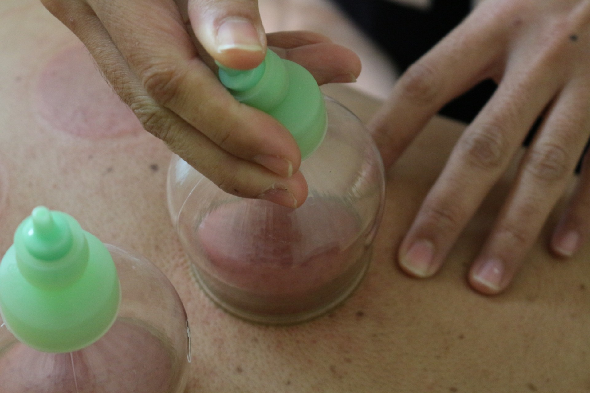 鍼灸ハリスト オイル吸玉脚全コース（吸玉後、オイルマッサージ）のメニュー画像