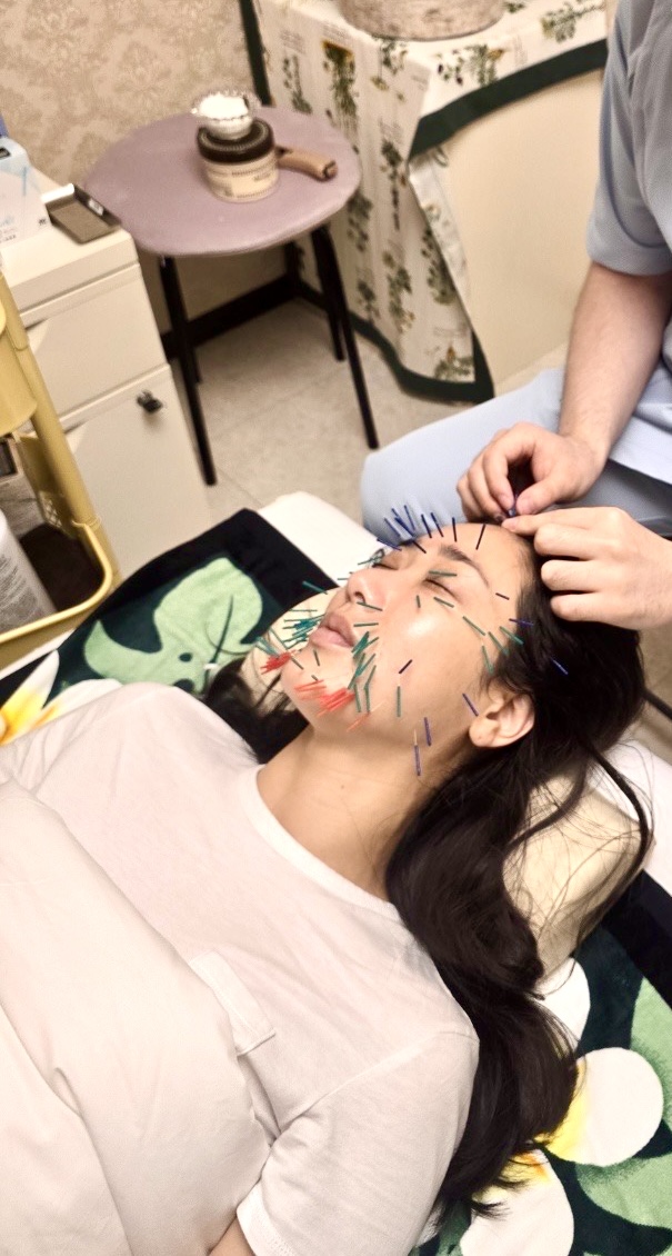 TAKAHANA鍼灸院 韓国式美容鍼のメニュー画像