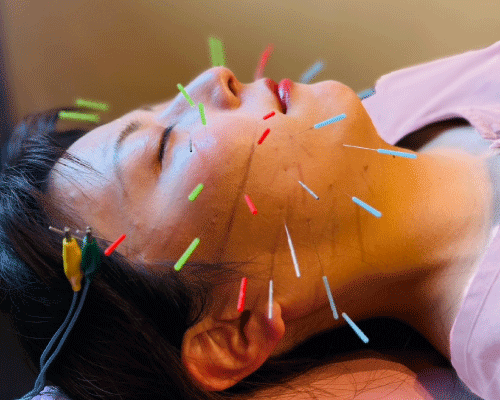 美容・不妊鍼灸 立川Ladies鍼灸マッサージ 産後ケア・更年期ケア 【スタンダードコース】美容鍼灸のメニュー画像